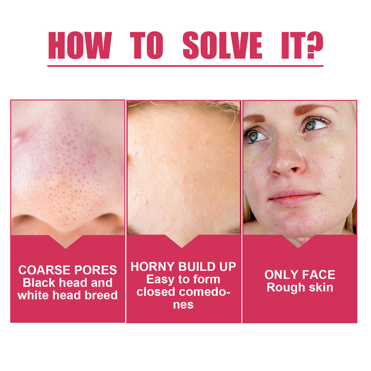 Pore Shrink Cream, Lightening Acne Print Anti-Aging Moisturizing Whitening Skin Anti-Wrinkle Cream